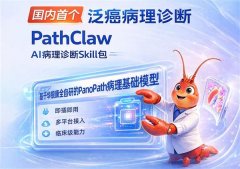 athClaw可极大缩短泛癌病理AI辅帮诊断所需时间